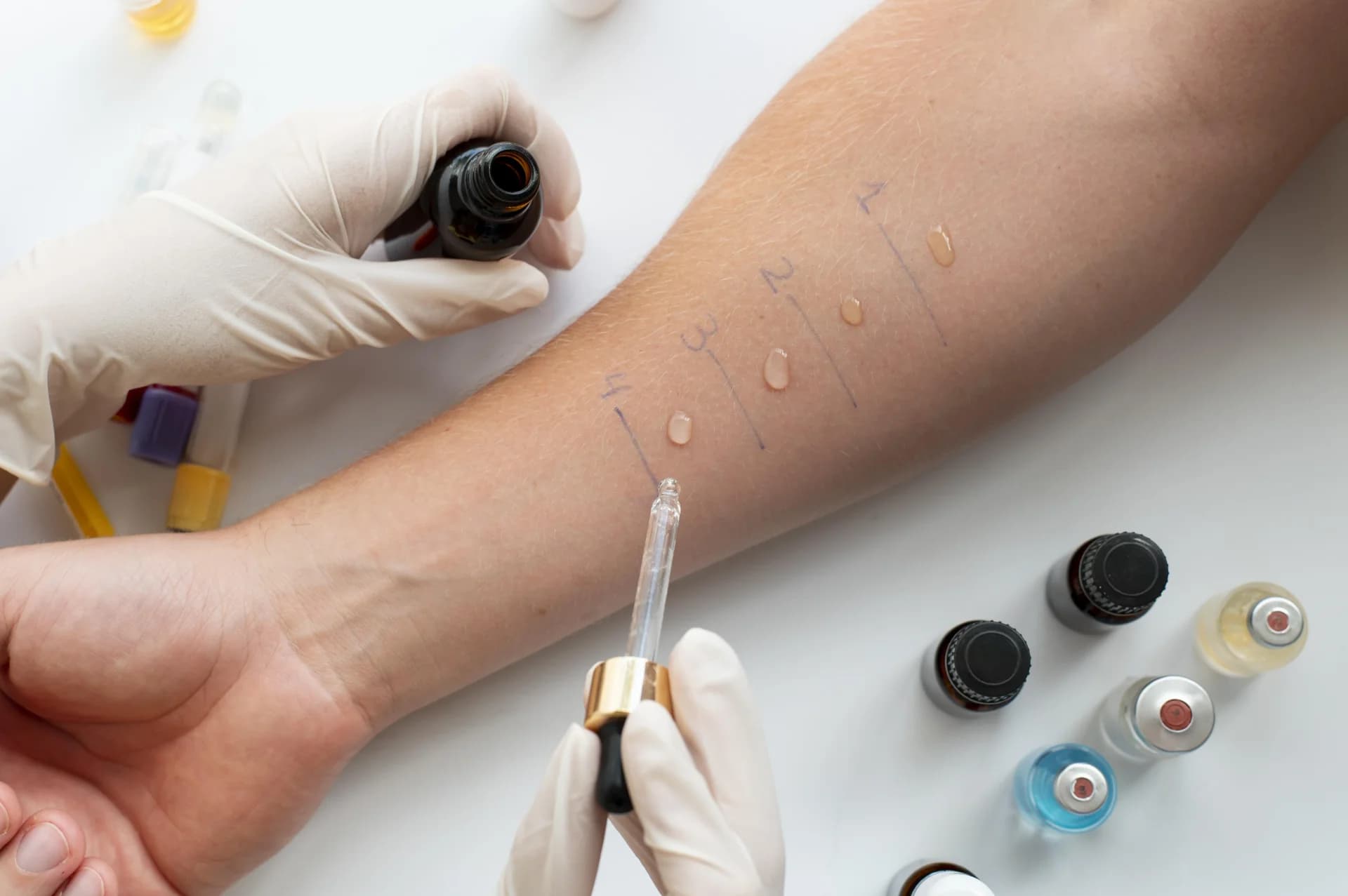 Patch Testing: Why It’s Essential Before using New Skincare Products